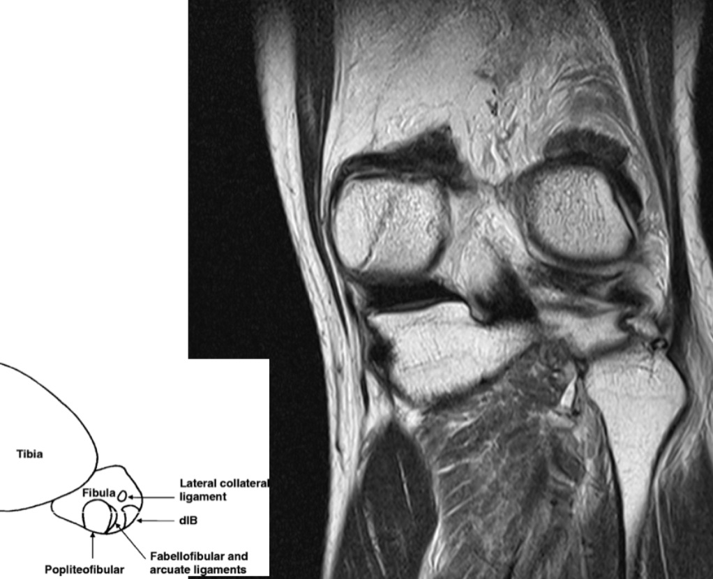 Figure 3 for case arcuate sign